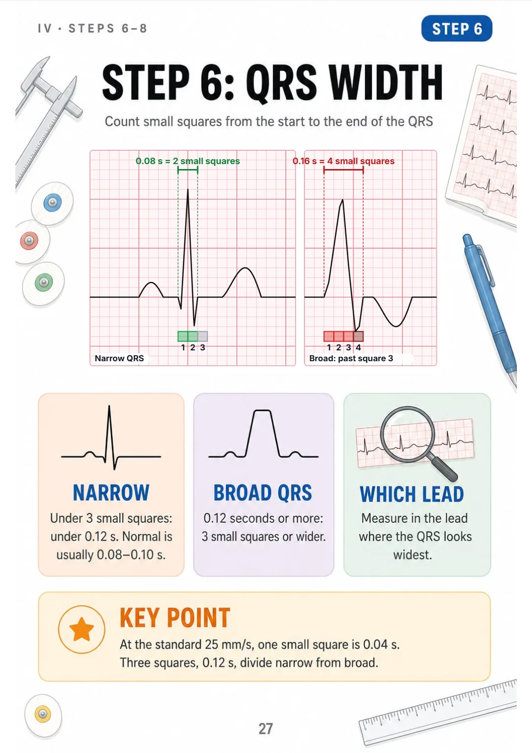QRS under 0.12 s (3 small squares) is narrow; 0.12 s or more is broad.