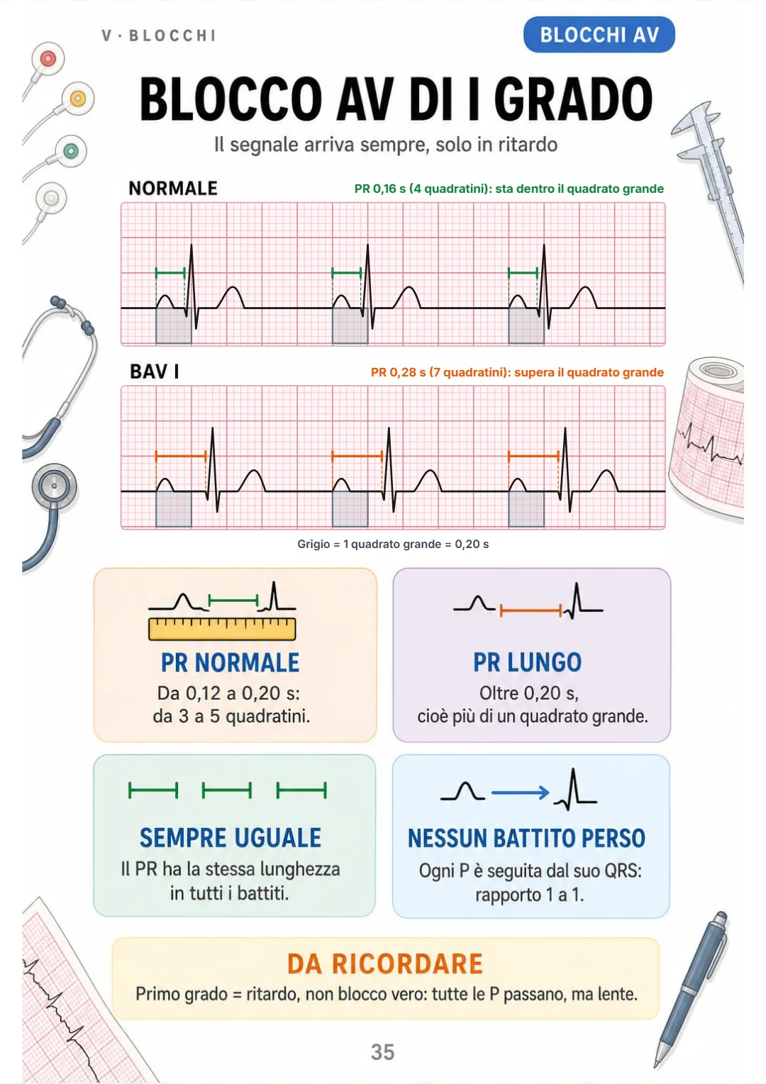 PR oltre 0,20 s, uguale in ogni battito, ogni P col suo QRS.