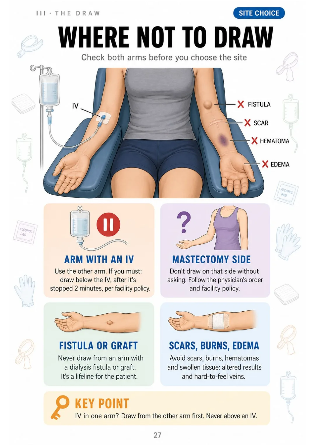 IV, mastectomy, fistula, scars, edema: where you never draw, marked on one arm.